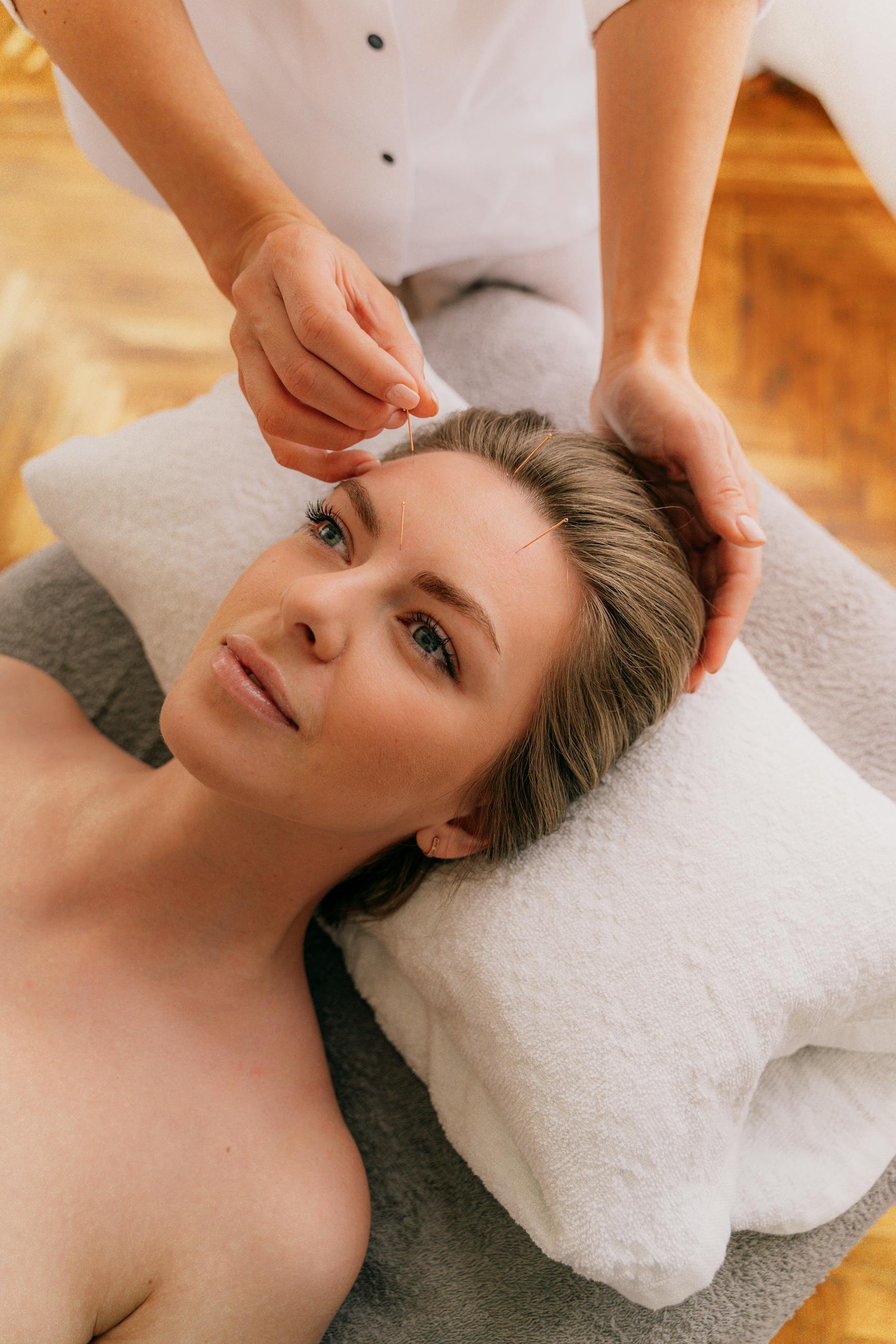 A serene acupuncture session with a woman lying peacefully on a massage table in a spa setting.